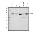 GLUR4 Antibody Human, Rat and Mouse WB. Western blot analysis was performed using GLUR4 Antibody. Lane 1: human SH-SY5Y whole cell lysate; lane 2: human 293T whole cell lysate; lane 3: rat C6 whole cell lysate; lane 4: mouse brain tissue lysate; lane 5: mouse Neuro-2a whole cell lysate. Proteins were separated on an 8% SDS-PAGE gel, transferred to a nitrocellulose membrane, and incubated with the primary antibody at 0.5 ug/ml overnight at 4Â°C. A specific immunoreactive band is detected at approximately 101 kDa in all tested samples, consistent with the expected molecular weight of GLUR4 (GRIA4). These results demonstrate that this AMPA Receptor Subunit Antibody is suitable for Western blot detection of GLUR4 across human and rodent neural tissues and cell lines.