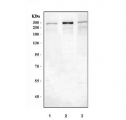 Western blot testing of 1) human HeLa, 2) rat brain and 3) mouse brain lysate with IP3R antibody at 1ug/ml. Predicted molecular weight ~314 kDa.
