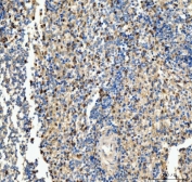 IHC staining of FFPE human spleen tissue with CD63 antibody. HIER: boil tissue sections in pH8 EDTA for 20 min and allow to cool before testing.