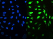 MCM7 Antibody for IF - immunofluorescence staining of human U-2 OS cells. FFPE human U-2 OS cells were stained with MCM7 Antibody for IF using a rabbit polyclonal antibody targeting Minichromosome maintenance complex component 7 / MCM7 (green). The signal localizes predominantly to cell nuclei, consistent with the known nuclear role of this DNA replication licensing factor. DAPI nuclear counterstain highlights cell nuclei (blue), demonstrating strong overlap with MCM7 staining in actively proliferating cells. Heat-induced epitope retrieval was performed by steaming sections in pH6 citrate buffer for 20 minutes prior to staining.