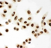 MCM7 Antibody ICC. Immunocytochemical staining of FFPE human A549 cells with MCM7 antibody. HIER: steam section in pH6 citrate buffer for 20 min.