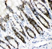 MCM7 Antibody Rat Intestine IHC. Immunohistochemistry staining of FFPE rat intestinal tissue with MCM7 antibody. HIER: boil tissue sections in pH8 EDTA for 20 min and allow to cool before testing.