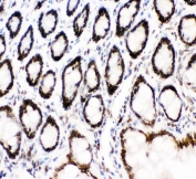 IHC staining of FFPE mouse intestine with MAD1 antibody. HIER: boil tissue sections in pH6, 10mM citrate buffer, for 20 min and allow to cool before testing.