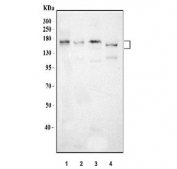 Western blot testing of 1) human HepG2, 2) rat liver, 3) rat RH35 and 4) mouse liver tissue lysate with ABCB4 antibody. Predicted molecular weight: 135-142 kDa (multiple isoforms).