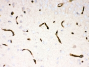 Dystrophin Antibody Mouse Brain Immunohistochemistry. IHC-P: Dystrophin antibody testing of mouse brain tissue.