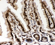 IHC-P testing of mouse intestine tissue. HIER: steamed with pH6 citrate buffer.