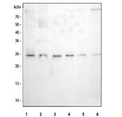Western blot testing of 1) human 293T, 2) human Raji, 3) human ThP-1, 4) human HeLa, 5) rat RH35 and 6) mouse NIH 3T3 cell lysate with MAD2L1 antibody. Predicted molecular weight ~24 kDa.