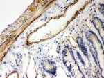IHC staining of FFPE rat intestinal tissue with IkB beta antibody, HRP-secondary and DAB substrate. HIER: boil tissue sections in pH8 EDTA for 20 min and allow to cool before testing.