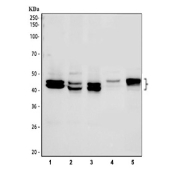 Western blot testing of 1) human HeLa, 2) human MCF7, 3) human Jurkat, 4) rat testis and 5) mouse testis tissue lysate with IkB beta antibody.  Western blot detection of IkB beta/NFKBIB shows a 40-45 kDa doublet across multiple lysates. The spacing is consistent with phosphorylated and unmodified forms of IkB beta.