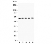 LRH-1 Antibody WB. Western blot testing of LRH-1 antibody and Lane 1:  PANC;  2: HEPG2;  3: A549;  4: SMMC-7721;  5: HeLa lysate.  Predicted/observed molecular weight: ~60kDa.