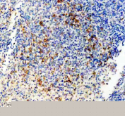 Immunohistochemical staining of FFPE human spleen tissue with P2X5 antibody, HRP-secondary and DAB substrate. HIER: boil tissue sections in pH8 EDTA for 20 min and allow to cool before testing.