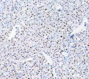 PARP Antibody Mouse Liver IHC. Immunohistochemistry analysis of FFPE mouse liver tissue using PARP1 Antibody / Chromatin Repair Protein Antibody. Hepatocyte nuclei demonstrate diffuse HRP-DAB brown staining consistent with the chromatin-associated role of PARP1 in DNA repair, oxidative stress adaptation, and genomic maintenance pathways within metabolically active hepatic tissue. Nuclei are counterstained blue. Heat-induced epitope retrieval was performed by boiling tissue sections in pH8 EDTA buffer for 20 minutes followed by cooling prior to staining.