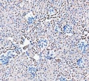 PARP1 Antibody Mouse Kidney IHC. Immunohistochemistry analysis of FFPE mouse kidney tissue using PARP1 antibody. Renal tubular epithelial cell nuclei demonstrate prominent HRP-DAB brown staining consistent with the chromatin-associated localization of PARP1 in DNA damage repair, genomic stability maintenance, and nuclear stress-response signaling pathways. Nuclei are counterstained blue. Heat-induced epitope retrieval was performed by boiling tissue sections in pH8 EDTA buffer for 20 minutes followed by cooling prior to staining.