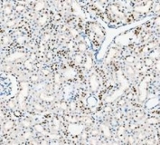 PARP1 Antibody Rat Kidney IHC. Immunohistochemistry analysis of FFPE rat kidney tissue using PARP1 antibody. Renal tubular epithelial cell nuclei demonstrate HRP-DAB brown staining consistent with the chromatin-associated activity of PARP1 in DNA strand break repair, genomic surveillance, and cellular stress-response signaling pathways within kidney tissue. Nuclei are counterstained blue. Heat-induced epitope retrieval was performed by boiling tissue sections in pH8 EDTA buffer for 20 minutes followed by cooling prior to staining.
