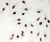 PARP1 Antibody A549 ICC. Immunocytochemistry analysis of human A549 cells using PARP1 antibody. Cell nuclei demonstrate strong HRP-DAB brown staining consistent with the chromatin-associated localization of PARP1 in DNA strand break repair, genomic stability maintenance, and nuclear stress-response signaling pathways. Nuclei are counterstained blue.