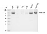 PKC alpha Antibody by WB in human cell lines and rodent brain tissue. Western blot analysis using PRKCA Polyclonal Antibody demonstrates immunoreactive bands in human and rodent samples. Lane 1 contains human U87 cell lysate; lane 2, human HEL cell lysate; lane 3, human A549 cell lysate; lane 4, human U2OS cell lysate; lane 5, rat brain lysate; and lane 6, mouse brain lysate. Each lane was loaded with 30 ug of total protein under reducing conditions. Proteins were separated by 5-20% SDS-PAGE and transferred to nitrocellulose. The membrane was incubated overnight at 4oC with the primary antibody at 0.5 ug/ml. Prominent bands migrate near the expected 77 kDa molecular weight, with differences in signal intensity among samples.