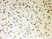 PKC Iota Antibody / PRKCI Antibody Rat Brain IHC. Immunohistochemical staining of FFPE rat brain tissue using PKC Iota Antibody / PRKCI Antibody. PRKCI expression is detected predominantly within the nuclei of neuronal cells, consistent with its conserved roles in neuronal polarity, intracellular signaling, and regulation of neural development and function. Heat-induced epitope retrieval was performed prior to immunostaining.