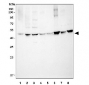 HSP47 Antibody Human, Mouse and Rat WB. Western blot analysis was performed using HSP47 Antibody on lysates from lane 1: human A431, lane 2: human SK-N-SH, lane 3: human HeLa, lane 4: rat lung, lane 5: rat kidney, lane 6: rat L6, lane 7: mouse lung, and lane 8: mouse NIH 3T3 cells. A prominent immunoreactive band is detected at approximately 46 kDa, consistent with the predicted molecular weight of HSP47 (SERPINH1). Comparable detection across human, rat, and mouse samples demonstrates broad species reactivity. This HSP47 Antibody, a Collagen Chaperone Antibody, is well suited for Western blot studies of collagen biosynthesis, endoplasmic reticulum function, extracellular matrix remodeling, and fibrosis research.