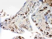 ApoE Antibody Human Placenta IHC. Immunohistochemical staining of FFPE human placental tissue with ApoE antibody. Heat-induced epitope retrieval (HIER) was performed by boiling tissue sections in pH 6 citrate buffer for 20 minutes and allowing them to cool prior to staining. ApoE immunoreactivity is observed predominantly within the cytoplasm and along the membranes of placental trophoblast cells, consistent with the expected localization of this lipid transport protein involved in cholesterol homeostasis and lipoprotein metabolism. Cell nuclei are counterstained with hematoxylin (blue).