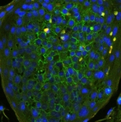 CD44 Antibody Human Tonsil IF. Immunofluorescence analysis of CD44 / CD44 antigen expression in FFPE human tonsil tissue using rabbit polyclonal antibody (green) with DAPI nuclear stain (blue). Membrane-associated fluorescence is observed in dense lymphoid cell populations, highlighting cell surface localization and distribution within lymphoid architecture. The staining pattern supports its use for visualizing CD44 expression and immune cell organization in human tonsil tissue. Heat induced epitope retrieval was performed by steaming tissue sections in pH 6 citrate buffer for 20 min.