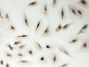 ICC testing of FFPE human A549 cells with LYRIC antibody. HIER: steam section in pH6 citrate buffer for 20 min and allow to cool prior to testing.