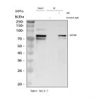 Metadherin Antibody Human Breast Cancer Cell IP. Immunoprecipitation of MTDH from human MCF-7 cell lysate using Metadherin antibody followed by Western blot analysis demonstrated efficient enrichment of the characteristic 70-75 kDa MTDH doublet. Lane 1 shows the input lysate, lane 2 is the rabbit IgG negative control, and lane 3 contains the immunoprecipitated MTDH complex obtained using 2 ug of antibody from 500 ug of lysate. The observed doublet is consistent with the known post-translationally modified forms of MTDH, which commonly migrate above the predicted molecular weight of approximately 64 kDa. This Metadherin Antibody, also called an MTDH Antibody, is useful for investigating protein interactions, tumor progression, metastasis, oncogenic signaling, and cancer biology.