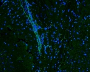 Vimentin Antibody / Tumor Microenvironment Immunofluorescence Marker Antibody. Immunofluorescence analysis of Vimentin / VIM in mouse brain tissue demonstrating green cytoplasmic and filamentous staining in stromal and supporting cell populations. The Vimentin Antibody / Tumor Microenvironment Immunofluorescence Marker Antibody used as a tumor microenvironment immunofluorescence marker highlights Vimentin-positive cells with elongated morphology and network-like distribution within the tissue. Nuclei are counterstained with DAPI (blue), supporting visualization of stromal architecture and microenvironment organization.