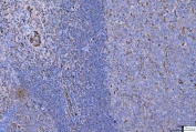 Vimentin Antibody / Tumor Microenvironment Marker Antibody Human Tonsil IHC. Immunohistochemical staining of FFPE human tonsil tissue using Vimentin Antibody / Tumor Microenvironment Marker Antibody. Vimentin expression is observed predominantly within stromal cells, vascular endothelial cells, and supporting mesenchymal cells of the tonsillar microenvironment, consistent with its role in maintaining tissue architecture, immune cell support, and extracellular matrix remodeling. Heat-induced epitope retrieval was performed by boiling tissue sections in pH 8 EDTA for 20 minutes followed by cooling prior to immunostaining.