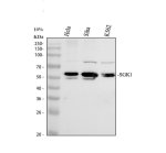 SGK1 Antibody Human Cancer Cell WB. Western blot analysis of SGK1 Antibody / Serine/Threonine Protein Kinase Antibody detected a prominent band at approximately 59 kDa in human cancer cell lysates, compared with the predicted molecular weight of approximately 49 kDa. Lanes: (1) human HeLa, (2) human SiHa, and (3) human K562 lysates. The upward mobility shift is consistent with post-translational modification of SGK1, particularly phosphorylation, which is known to alter its apparent molecular weight during SDS-PAGE. This SGK1 Antibody supports western blot studies of serine/threonine protein kinase signaling and SGK1 activation in human cancer cell models.