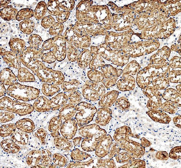 SLC22A2 Antibody Human Kidney IHC. Immunohistochemical staining of FFPE human kidney tissue with SLC22A2 antibody at 2 ug/ml. Heat-induced epitope retrieval (HIER) was performed by boiling tissue sections in pH 8 EDTA buffer prior to staining. SLC22A2 immunoreactivity is observed predominantly along the basolateral membranes and within the cytoplasm of renal tubular epithelial cells, consistent with the expected localization of this organic cation transporter involved in renal drug transport, xenobiotic uptake, and clearance of endogenous cationic compounds. Cell nuclei are counterstained with hematoxylin (blue).