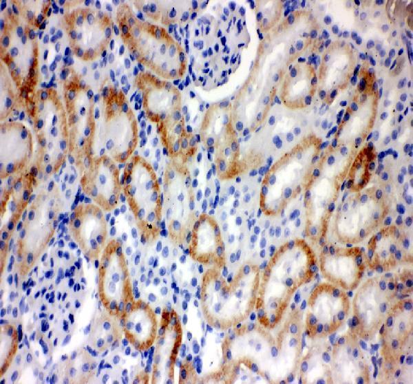 SLC22A2 Antibody Rat Kidney IHC. Immunohistochemical staining of FFPE rat kidney tissue with SLC22A2 antibody. Heat-induced epitope retrieval (HIER) was performed by boiling tissue sections in pH 8 EDTA buffer for 20 minutes and allowing them to cool prior to staining. SLC22A2 immunoreactivity is observed predominantly along the basolateral membranes and within the cytoplasm of renal tubular epithelial cells, consistent with the expected localization of this organic cation transporter responsible for renal uptake of endogenous cations, therapeutic drugs, and other xenobiotic compounds. Cell nuclei are counterstained with hematoxylin (blue).