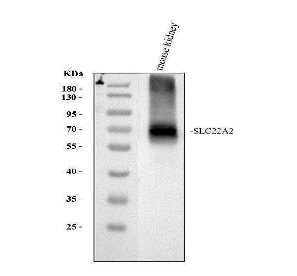 SLC22A2 Antibody Mouse Kidney WB. Western blot testing of mouse kidney tissue lysate with SLC22A2 antibody at 0.5 ug/ml. A strong band is detected at approximately 63 kDa, consistent with the predicted molecular weight of SLC22A2. The results demonstrate specific detection of this organic cation transporter, which is highly expressed in renal tubular epithelial cells and plays a key role in the uptake and clearance of endogenous cations, therapeutic drugs, and other xenobiotic compounds.