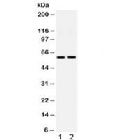 DGAT1 Antibody Rat Kidney and HeLa WB. Western blot analysis of DGAT1 expression was performed using anti-DGAT1 antibody in rat kidney and human HeLa lysates. DGAT1, also known as Diacylglycerol O-Acyltransferase 1, catalyzes the final step of triglyceride synthesis and plays a key role in lipid droplet formation and energy homeostasis. Lane 1: rat kidney lysate. Lane 2: human HeLa lysate. A specific immunoreactive band is detected at approximately 45-55 kDa in both samples, corresponding to the predicted molecular weight of DGAT1 (~55 kDa). Similar expression in renal and epithelial cell lysates is consistent with the widespread requirement for triglyceride biosynthesis and cellular lipid storage. These results support the utility of DGAT1 Antibody for studies of lipid metabolism, energy homeostasis, and metabolic disease.