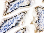 IHC testing of FFPE mouse intestine with ZBTB7A antibody. HIER: Boil the paraffin sections in pH 6, 10mM citrate buffer for 20 minutes and allow to cool prior to staining.