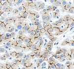ABCB11 Antibody Canalicular Human Liver IHC. Immunohistochemical staining of FFPE human liver tissue using ABCB11 Antibody / Bile Salt Export Pump Antibody at 2 ug/ml. An HRP-conjugated goat anti-rabbit IgG secondary antibody with DAB substrate was used for detection. ABCB11 Antibody demonstrates strong canalicular membranous staining outlining adjacent hepatocytes in a characteristic chicken-wire pattern, consistent with the normal localization of the bile salt export pump in liver tissue.