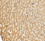 ABCB11 Antibody Human Liver IHC. Immunohistochemical staining of FFPE human liver tissue using ABCB11 Antibody / Bile Salt Export Pump Antibody at 2 ug/ml. An HRP-conjugated goat anti-rabbit IgG secondary antibody with DAB substrate was used for detection. ABCB11 Antibody demonstrates strong membranous staining of hepatocytes, consistent with canalicular localization of the bile salt export pump, with minimal background staining in the surrounding liver tissue.