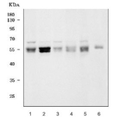 Western blot testing of 1) human K562, 2) human HepG2, 3) human Caco-2, 4) human SiHa, 5) human U-2 OS and 6) rat PC-12 cell lysate with STAU1 antibody. Predicted molecular weight: ~55 kDa (short form) and 63 kDa (long form). The ~55 kDa STAU1 band appears as a doublet in several samples, consistent with phosphorylation-dependent mobility shifts and known N-terminal isoform heterogeneity reported for the STAU1-55 protein.
