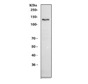Ceruloplasmin Antibody HepG2 Western Blot. Western blot analysis of human HepG2 cell lysate using Ceruloplasmin Antibody / Iron Metabolism Protein Antibody demonstrates a distinct band at approximately 130-140 kDa, consistent with expression of Ceruloplasmin (CP). Ceruloplasmin is a multicopper ferroxidase that plays a central role in iron metabolism, copper transport, and maintenance of metal ion homeostasis. By catalyzing the oxidation of ferrous iron to ferric iron, Ceruloplasmin facilitates iron transport and utilization while contributing to systemic mineral balance and cellular metabolic regulation. The observed molecular weight is consistent with the heavily glycosylated nature of Ceruloplasmin, which commonly migrates above its predicted molecular weight of approximately 122 kDa during SDS-PAGE analysis.