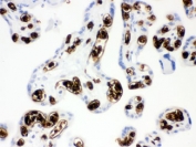Band 3 Antibody Human Placenta IHC. Immunohistochemical staining of FFPE human placenta tissue using Band 3 Antibody / Anion Exchange Protein 1 Antibody demonstrates strong membranous and cytoplasmic HRP-DAB brown staining within placental trophoblast cell populations. Band 3 (AE1/SLC4A1) is a chloride/bicarbonate exchanger that mediates transmembrane ion transport and contributes to maintenance of acid-base balance and cellular ionic homeostasis. In addition to its well-established role in erythrocyte membrane physiology, Band 3 family proteins participate in transport processes that support cellular metabolism and physiologic homeostasis in specialized epithelial tissues. The observed placental staining pattern is consistent with expression of anion transport machinery involved in regulation of bicarbonate and chloride exchange. HIER: boil paraffin sections in pH 6, 10 mM citrate buffer for 20 minutes and allow to cool prior to staining.