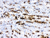 Band 3 Antibody Mouse Kidney IHC. Immunohistochemical staining of FFPE mouse kidney tissue using Band 3 Antibody / Anion Exchange Protein 1 Antibody demonstrates strong membranous and cytoplasmic HRP-DAB brown staining within renal tubular epithelial cells. Band 3 (AE1/SLC4A1) is a chloride/bicarbonate exchanger that plays an important role in bicarbonate transport, acid-base regulation, and maintenance of cellular ionic homeostasis. In the kidney, AE1 contributes to physiologic mechanisms that regulate systemic acid-base balance through coordinated ion exchange and bicarbonate handling. The observed tubular staining pattern is consistent with the established role of Anion Exchange Protein 1 in renal epithelial transport processes and kidney physiology. HIER: boil paraffin sections in pH 6, 10 mM citrate buffer for 20 minutes and allow to cool prior to staining.