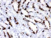 Band 3 Antibody Rodent Kidney IHC. Immunohistochemical staining of FFPE rat kidney tissue using Band 3 Antibody / Anion Exchange Protein 1 Antibody demonstrates strong membranous and cytoplasmic HRP-DAB brown staining within renal tubular epithelial cells. Band 3 (AE1/SLC4A1) is a chloride/bicarbonate exchanger that plays a critical role in bicarbonate transport, acid-base regulation, and maintenance of cellular ionic homeostasis. In addition to its well-established function in erythrocyte membranes, AE1 is expressed in specialized renal epithelial cells where it contributes to physiologic acid-base balance through regulation of bicarbonate and chloride exchange. The observed tubular staining pattern is consistent with the established role of Band 3 family proteins in kidney ion transport and maintenance of renal homeostasis. HIER: boil paraffin sections in pH 6, 10 mM citrate buffer for 20 minutes and allow to cool prior to staining.