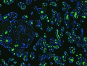 Band 3 Antibody Human Placenta IF. Immunofluorescent staining of FFPE human placenta tissue using Band 3 Antibody / Anion Exchange Protein 1 Antibody demonstrates strong green fluorescence within placental trophoblast cell populations, while nuclei are counterstained with DAPI (blue). Band 3 (AE1/SLC4A1) is a chloride/bicarbonate exchanger that mediates transmembrane ion transport and contributes to maintenance of cellular acid-base balance and ionic homeostasis. Although best known as a major erythrocyte membrane protein, AE1-related transport mechanisms are also associated with specialized epithelial cells that require regulated bicarbonate and chloride exchange. The observed trophoblast-associated fluorescence pattern is consistent with expression of anion transport proteins involved in placental physiology, membrane transport, and cellular homeostasis. HIER: boil paraffin sections in pH 6, 10 mM citrate buffer for 20 minutes and allow to cool prior to staining.