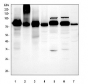 Western blot testing of 1) human placenta, 2) human HCCT, 3) human HCCP, 4) human HepG2, 5) rat liver, 6) mouse liver and 7) mouse HEPA1-6 cell lysate with Transferrin antibody. Expected molecular weight ~77 kDa.