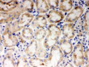 CYP1A1 Antibody Mouse Kidney IHC (Frozen). IHC staining of frozen mouse kidney tissue with CYP1A1 antibody demonstrated cytoplasmic staining in renal tubular epithelial cells. CYP1A1 is a heme-containing cytochrome P450 monooxygenase that catalyzes Phase I xenobiotic metabolism and is induced through aryl hydrocarbon receptor (AHR) signaling following exposure to environmental chemicals. In the kidney, CYP1A1 participates in the oxidative metabolism of endogenous substrates and xenobiotics, contributing to detoxification and metabolic homeostasis. These results support the utility of CYP1A1 Antibody for studies of xenobiotic metabolism, drug metabolism, AHR signaling, renal biology, and environmental toxicology.