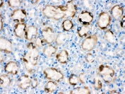 CYP1A1 Antibody Rat Kidney IHC. IHC staining of FFPE rat kidney with CYP1A1 antibody demonstrated cytoplasmic staining in renal tubular epithelial cells. CYP1A1 is a heme-containing cytochrome P450 monooxygenase that catalyzes Phase I xenobiotic metabolism and is induced through aryl hydrocarbon receptor (AHR) signaling following exposure to environmental chemicals. In the kidney, CYP1A1 contributes to the oxidative metabolism of endogenous compounds, drugs, and xenobiotics, supporting detoxification and metabolic homeostasis. HIER was performed by boiling tissue sections in pH 6, 10 mM citrate buffer for 20 minutes followed by cooling prior to staining. These results support the utility of CYP1A1 Antibody for studies of xenobiotic metabolism, drug metabolism, AHR signaling, renal biology, and environmental toxicology.