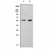 Western blot testing of 1) rat brain and 2) mouse brain lysate with Tyrosine Hydroxylase antibody. Expected molecular weight 55~60 kDa.