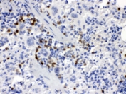 Immunohistochemistry of Csf-1 antibody in mouse spleen tissue. FFPE mouse spleen sections were subjected to heat-induced epitope retrieval by boiling in pH 6, 10 mM citrate buffer for 20 minutes followed by cooling prior to staining. Csf-1 antibody demonstrates HRP-DAB brown cytoplasmic staining in scattered splenic immune cells within the white pulp and perifollicular regions, while surrounding lymphoid populations show minimal background staining. The distribution is consistent with expression of Colony stimulating factor 1 in splenic stromal and myeloid-associated compartments.