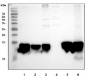Western blot analysis of FABP antibody in rodent tissues. Rat liver (lane 1), rat intestine (lane 2), rat RH35 cells (lane 3), rat PC-12 cells (lane 4), mouse liver (lane 5), and mouse small intestine (lane 6) lysates were analyzed using FABP antibody rabbit polyclonal. The predicted molecular weight of Liver fatty acid binding protein is approximately 14 kDa. A strong band is observed near 14 kDa in rat and mouse liver samples, consistent with high FABP1 expression in hepatocytes. Clear bands are also detected in rat and mouse intestinal tissues, reflecting known expression in enterocytes. Signal in RH35 cells is present and consistent with hepatic origin, while PC-12 cells show minimal to low expression. The observed band pattern aligns with the expected tissue distribution of FABP1.