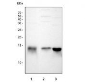 FABP Antibody Rabbit Polyclonal WB. Western blot testing of 1) human HCCT, 2) monkey liver and 3) chicken liver tissue lysate with FABP antibody. Predicted molecular weight: ~14 kDa.