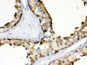 HSP90 alpha Antibody Testis IHC. Immunohistochemistry staining of FFPE human testis using HSP90 alpha Antibody / Heat Shock Protein 90 Alpha Antibody demonstrates strong cytoplasmic HRP-DAB brown staining within seminiferous tubule germ cell populations. The staining pattern is consistent with expression of HSP90 alpha (HSP90AA1), a highly conserved ATP-dependent molecular chaperone involved in protein folding, stabilization of client proteins, cellular stress responses, and maintenance of proteostasis. HSP90 alpha is highly expressed in metabolically active and proliferative cell populations, where it supports the maturation and function of numerous signaling and regulatory proteins. HIER was performed by boiling paraffin sections in pH 6, 10 mM citrate buffer for 20 minutes followed by cooling prior to immunostaining.